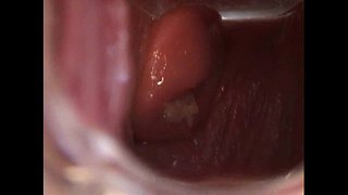 Авы otvoriti Maca sa зеркальцем